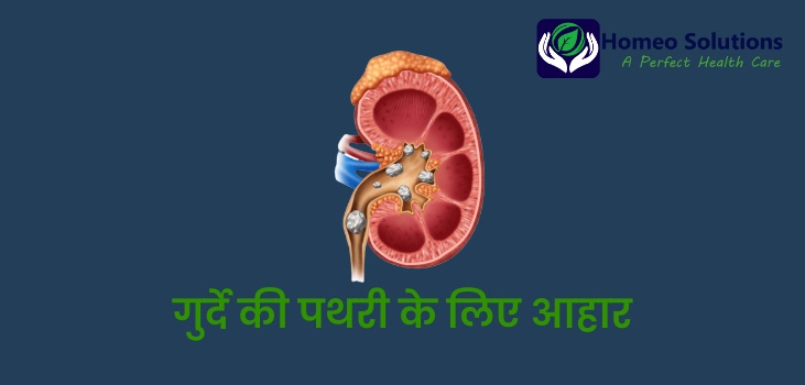 kidney-stones-prevention